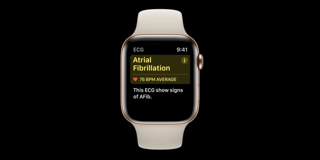 iOS 14 HealthKit updates ECG, symptoms, more