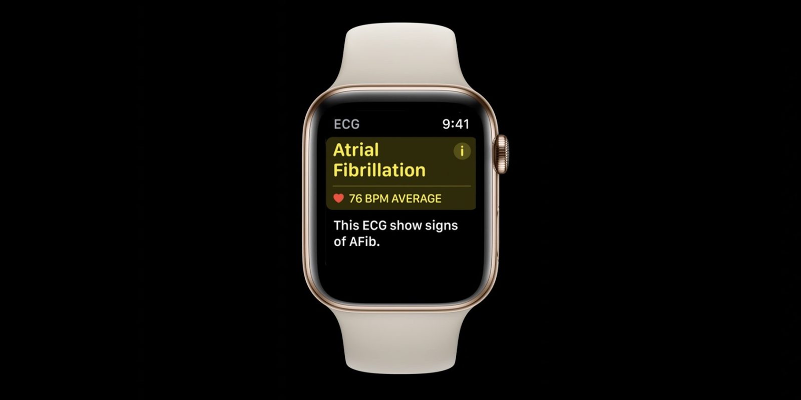 iOS 14 HealthKit updates ECG, symptoms, more